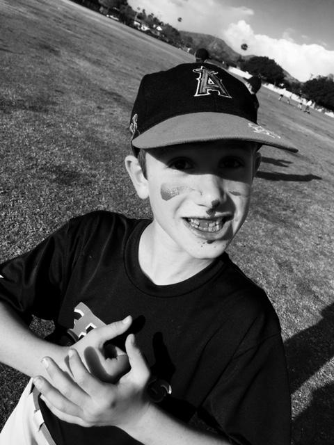Baseball Safety: Picture of a baseball players with a bloody nose after being hit by a ground ball